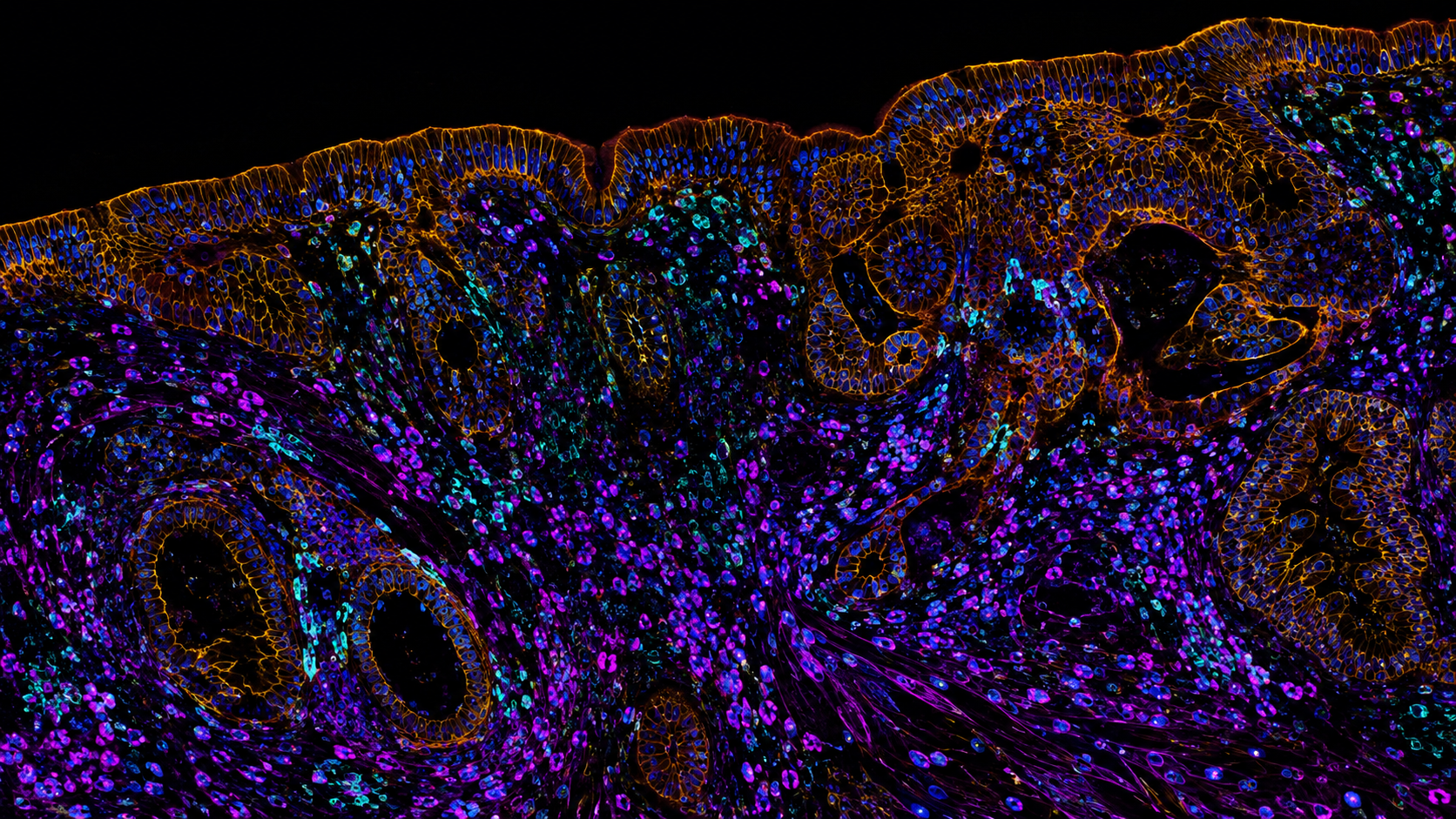 High-resolution spatial pathology fluorescence tissue image
